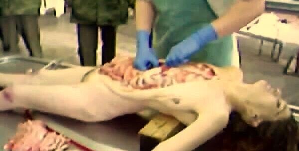 Autopsy Cwe Cakep..Meninggal habis lari Marathon