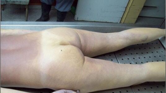Autopsy Cwe Cakep..Meninggal habis lari Marathon