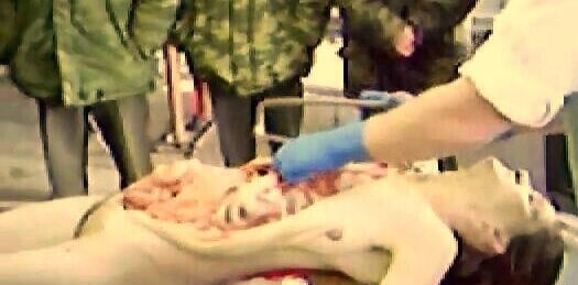 Autopsy Cwe Cakep..Meninggal habis lari Marathon