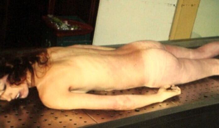 Autopsy Cwe Cakep..Meninggal habis lari Marathon