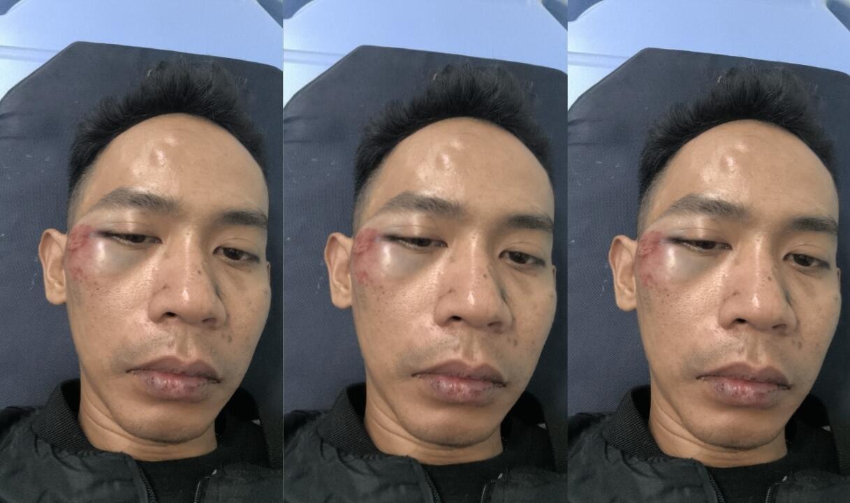 Cekcok Berujung Brutal! Pria di Koja Dikeroyok Sekelompok Orang