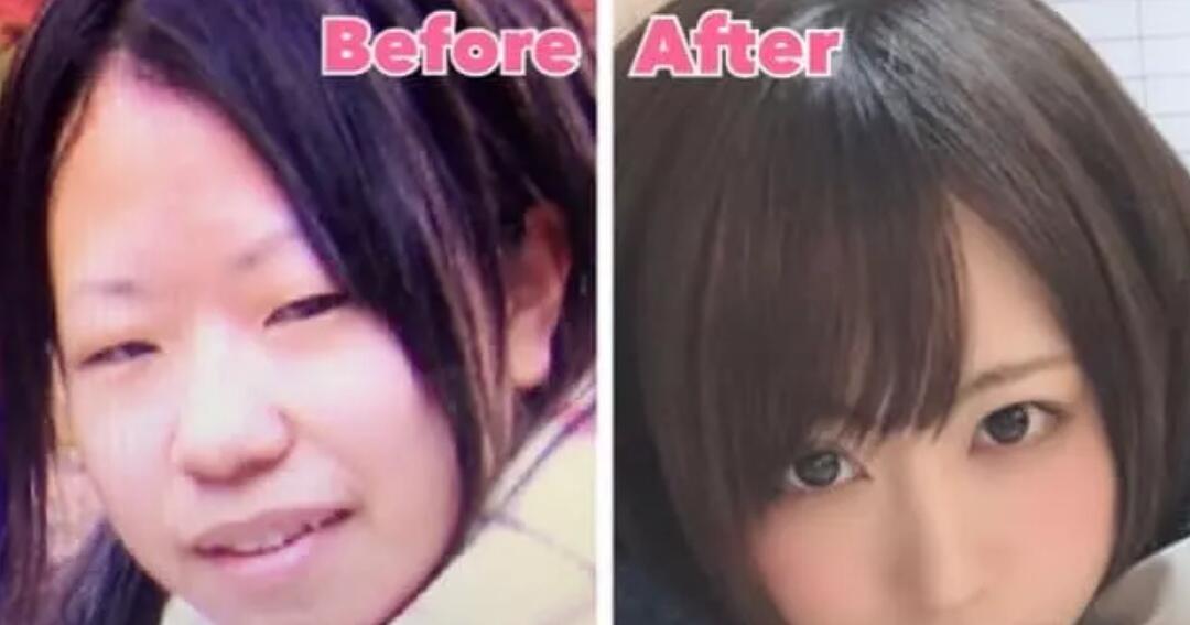 Heboh Foto Hasil Oplas Gadis Cantik Jepang Ini Mencuri Perhatian Netizen Kaskus 2118