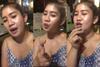 Nggak Langsung Cantik, Foto Wanita Setelah Operasi Plastik Ini Bikin Merinding Disko
