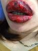 Pakai Tattoo Lip KW, Bibir Wanita ini Alami Infeksi sampai Membengkak Parah
