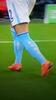 Kyle Walker Tampil dengan Kaos Kaki Bolong-bolong untuk Hilangkan Rasa Sakit Otot