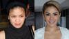 4 Seleb Ini Blak-blakan Pernah Jalani Operasi Plastik, Before & After-nya Beda Jauh!