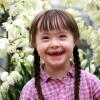 Yuk Mengenal 4 Macam Kelainan Trisomi, Down Syndrome Itu Salah Satunya