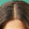 Rambutmu Cepat Lepek, Girls? Ini 6 Cara Menyelamatkannya!