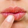 9 Cara Mudah Ini Tak Disangka Bisa Mengurangi Rasa Sakit Kepalamu loh!