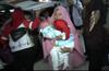 Tim Dokter RSUD dr Soetomo Berhasil Pisahkan Bayi Kembar Siam asal Kendari
