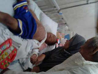 Kesal, Lidah Bayi 3,5 Tahun Digunting