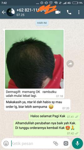 Dermagift Penumbuh Rambut Cegah Botak dan Kerontokan