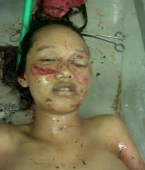 Wanita Hamil 7 Bulan, Dibantai di Warung Es Ponorogo
