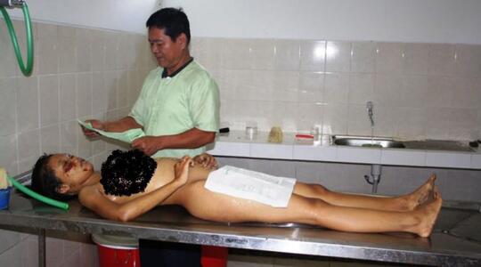 Wanita Hamil 7 Bulan, Dibantai di Warung Es Ponorogo