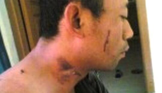 Polisi Kantongi Identitas Penyiram Air Keras di Bus