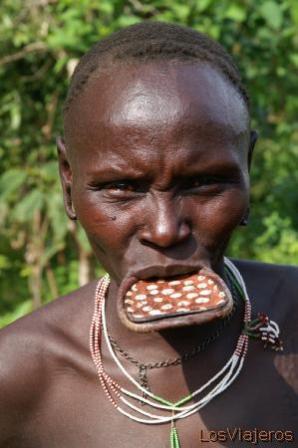 Mengenal Tradisi di Ethiopia, Semakin Lebar Bibir Wanita Semakin Dianggap Cantik