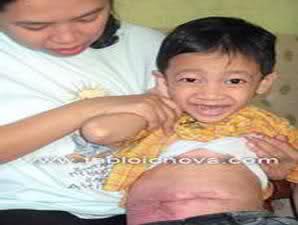Akibat Buruk Jika Terlalu Banyak Makan Mie Instan