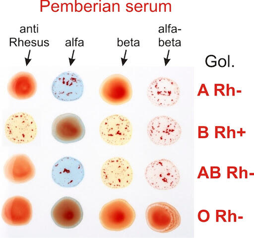 Sifat Golongan Darah A , B , O , AB
