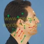 Fakta-fakta Bell's Palsy, Penyakit yang Bikin Wajah Rano Karno Kaku Separuh