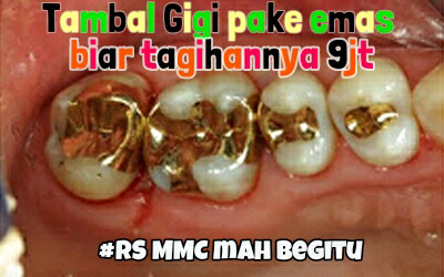 Tambal gigi Rp. 9,000,000