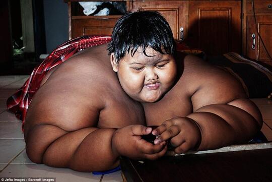 Anak Paling Gemuk di Dunia Ternyata Berasal dari Indonesia