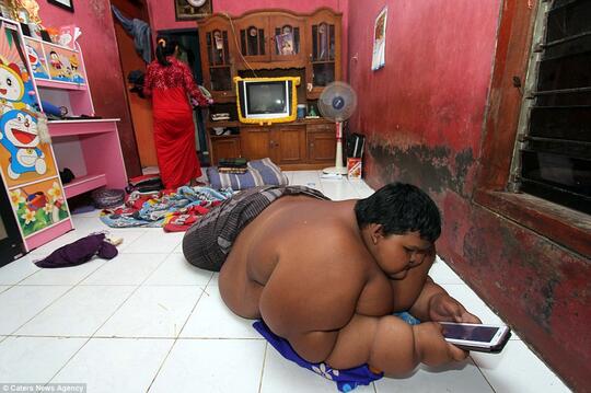 Anak Paling Gemuk di Dunia Ternyata Berasal dari Indonesia