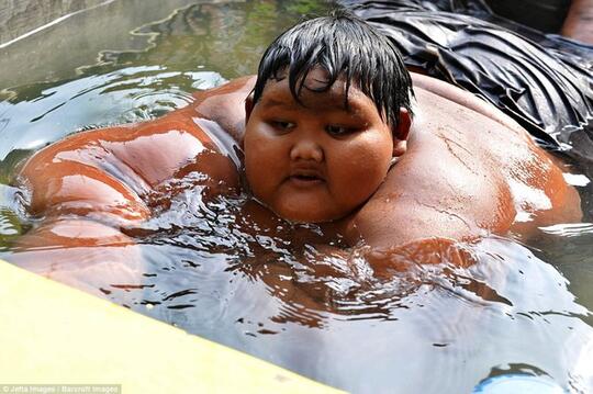 Anak Paling Gemuk di Dunia Ternyata Berasal dari Indonesia