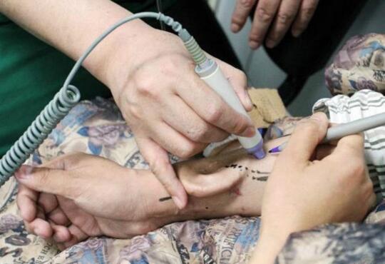 Dokter di China Sukses Tumbuhkan Telinga di Tangan Pasien