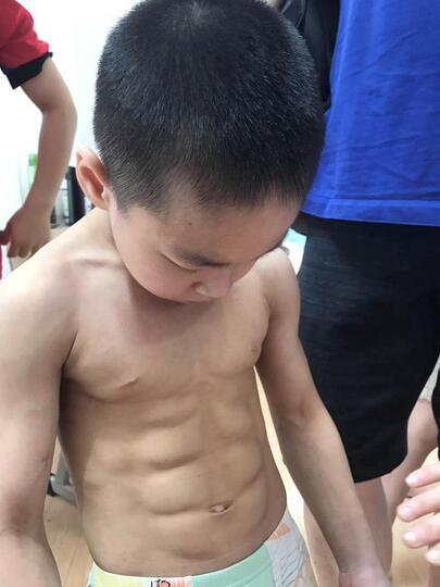 Kisah sedih di balik bocah 7 tahun yang punya perut sixpack