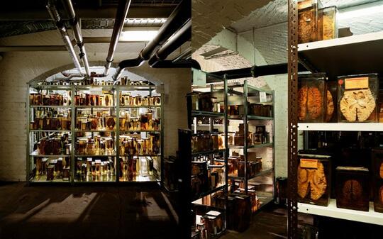 10 Museum Medis Paling Aneh & Menyeramkan di Dunia