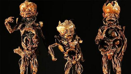 10 Museum Medis Paling Aneh & Menyeramkan di Dunia