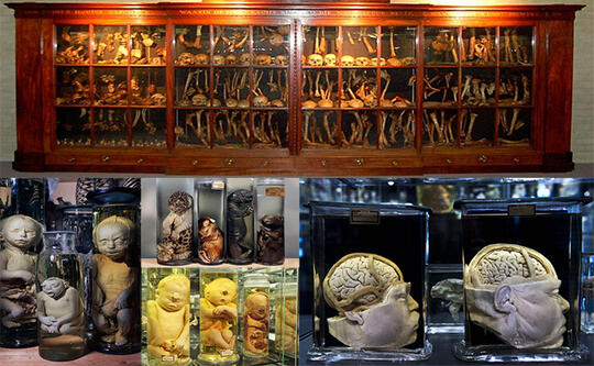 10 Museum Medis Paling Aneh & Menyeramkan di Dunia
