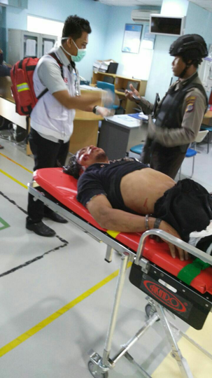 Terjadi Penyerangan di Gereja St Lidwina Sleman !!!