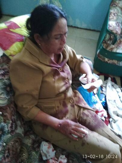 Tak Terima Anaknya Ditegur, Wali Murid Aniaya Kepala Sekolah Hingga Berdarah-Darah