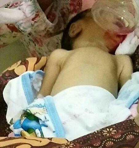 Sedih! Diberi Makanan Padat oleh Neneknya, Bayi Ini Alami Pendarahan hingga Meninggal