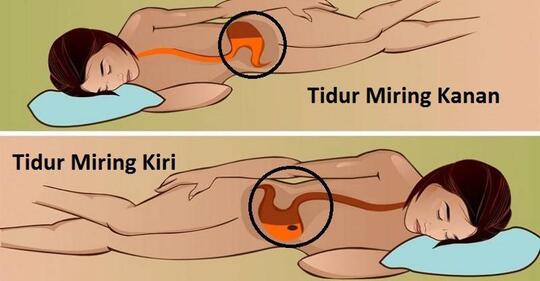 Yang Mana Lebih Menyehatkan Tidur Miring Kiri Atau Miring