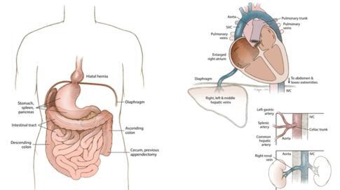 Unik ! Wanita Ini Hidup Hingga Usia Lanjut Tanpa Sadar Organ Tubuhnya Terbalik