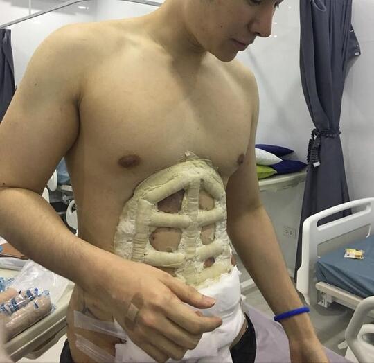 Gila, Thailand Sudah Menyediakan Perut Six Pack Palsu ! Mau ?