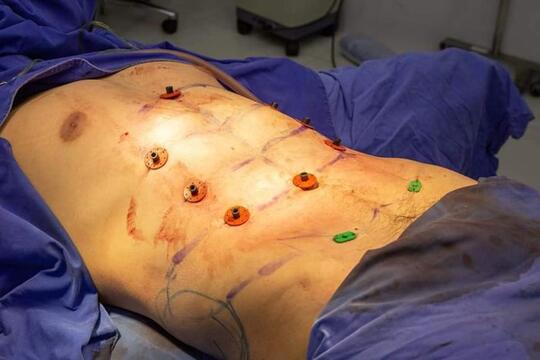 Gila, Thailand Sudah Menyediakan Perut Six Pack Palsu ! Mau ?