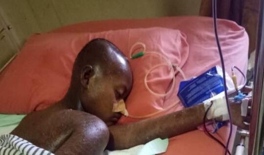 Bantu Adinda Nurul urul sembuh dari Steven Johnson Syndrome