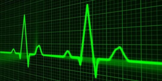 Mengenal Teknologi ECG, Pengukur Aktivitas Listrik pada Jantung Kita