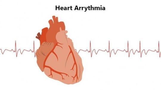 Mengenal Teknologi ECG, Pengukur Aktivitas Listrik pada Jantung Kita