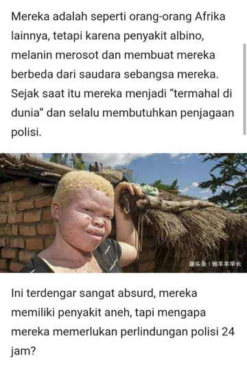Misteri Albinisme Yang Diburu Dan Dihargai Paling Mahal Darahnya, Benarkah Demikian?