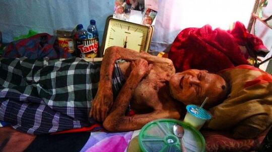 Tega! Kakek 98 Tahun Ditelantarkan 4 Anaknya, Lumpuh dan Tak Mandi 9 Bulan.