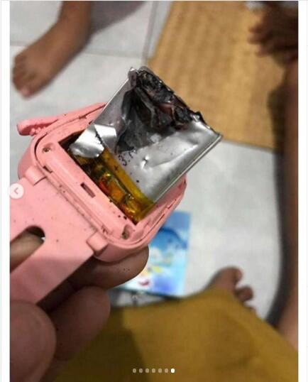 Viral Meledaknya Smartwatch Harga Murah di Tangan Anak-anak Sampai Melepuh