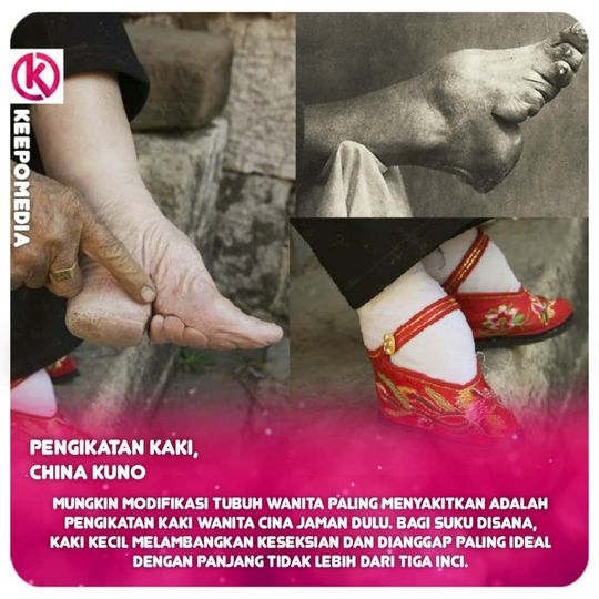 Standar Kecantikan Ekstrem Dari Berbagai Negara, Salah Satunya Dari Indonesia