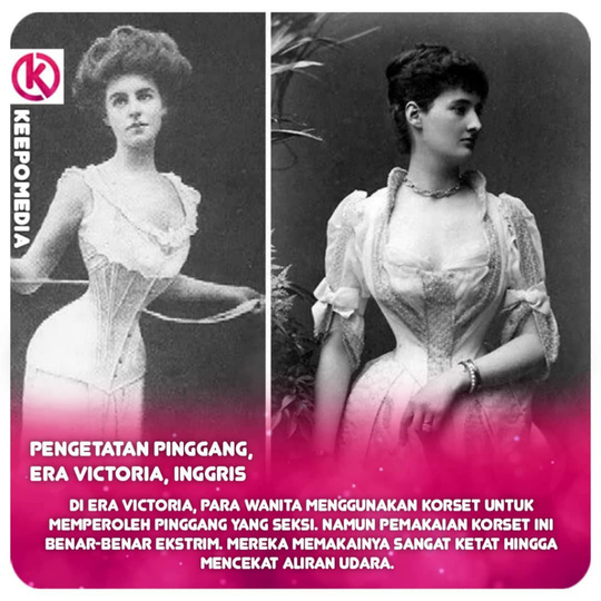Standar Kecantikan Ekstrem Dari Berbagai Negara, Salah Satunya Dari Indonesia