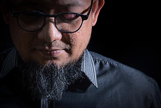 Kasus Novel Baswedan hanya Rekayasa?, tersebar Video "Mata baik-baik saja"