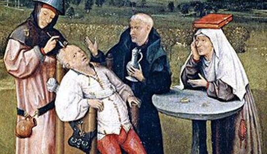 Trepanation, Sebuah Metode Pengobatan Zaman Dulu dengan Cara Mengebor Tengkorak!