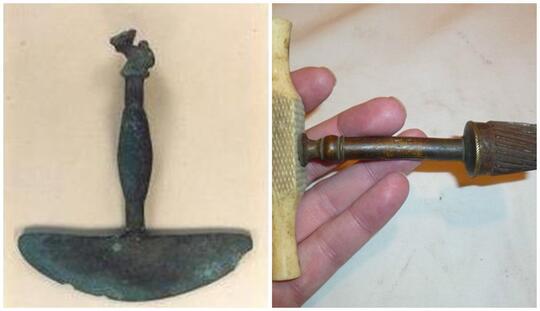 Trepanation, Sebuah Metode Pengobatan Zaman Dulu dengan Cara Mengebor Tengkorak!